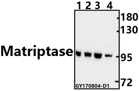 Western blot (WB) analysis of Matriptase (K21) pAb at 1:500 dilution
Lane1:C6 whole cell lysate(40ug)
Lane2:CT26 whole cell lysate(40ug)
Lane3:HCT116 whole cell lysate(40ug)
Lane4:PC3 whole cell lysate(40ug)
