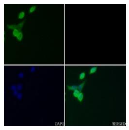 Immunofluorescent analysis of FOSL2 staining in MCF7 cells