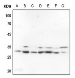 Western blot analysis of FOSL2 expression in HEK293T (A), Hela (B), H446 (C), mouse liver (D), mouse kidney (E), rat liver (F), rat kidney (G) whole cell lysates