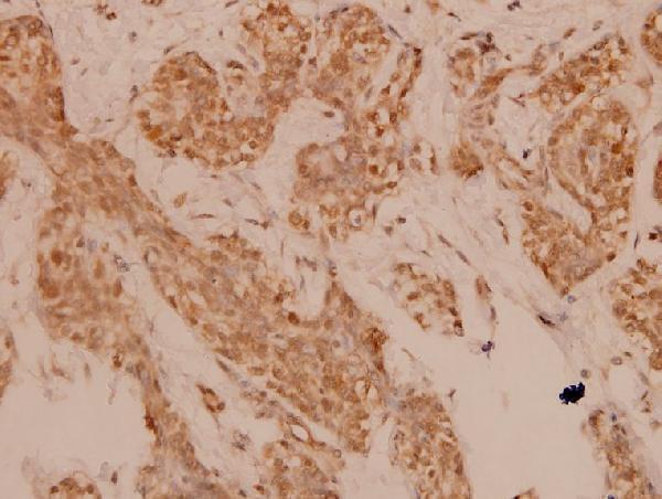 a02615s301 fosl2 primary antiboties ihc testing 2