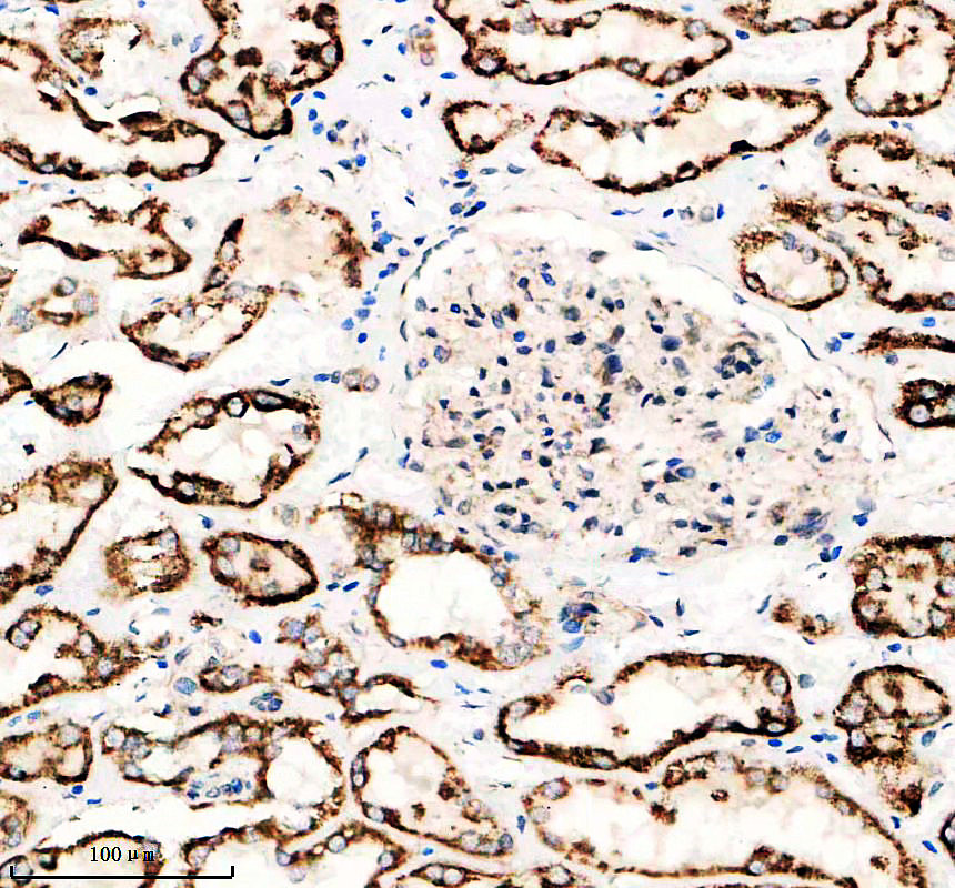 a02616 1 kl primary antibodies ihc testing 1