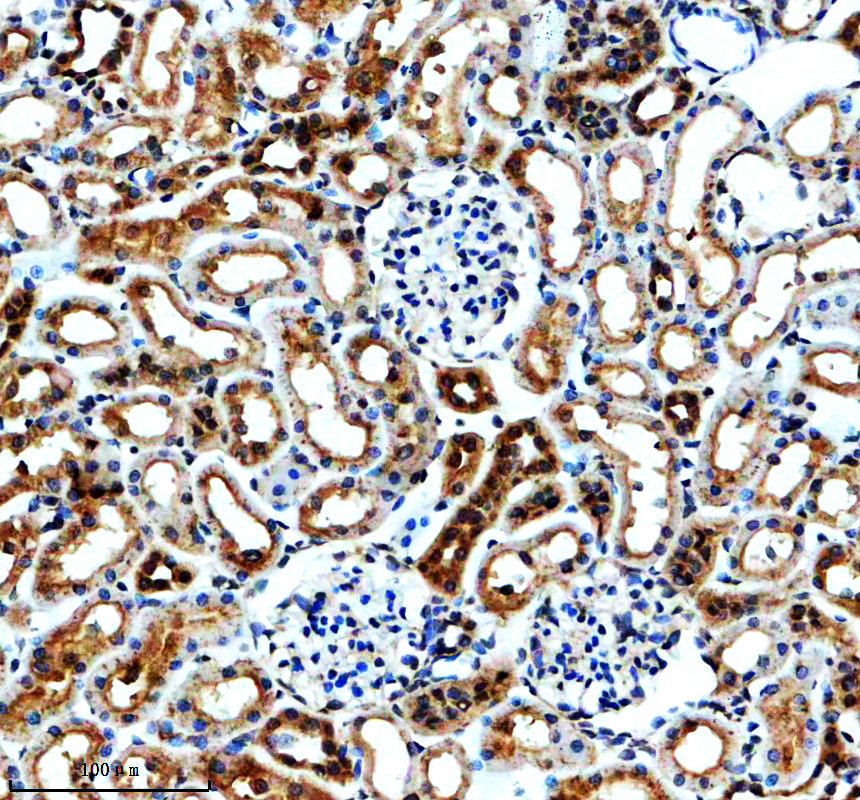 a02616 1 kl primary antibodies ihc testing 2