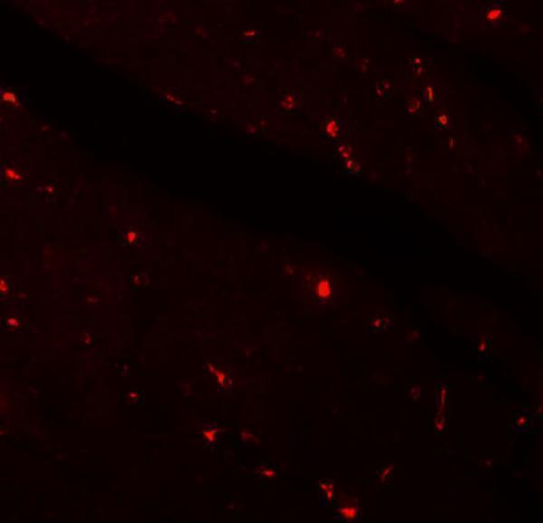 a02616 kl primary antibodies if testing 5
