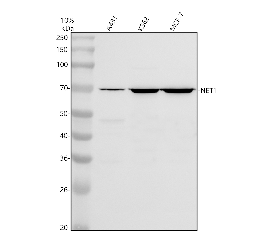 Western blot analysis of NET1 using anti-NET1 antibody (A02618-1)