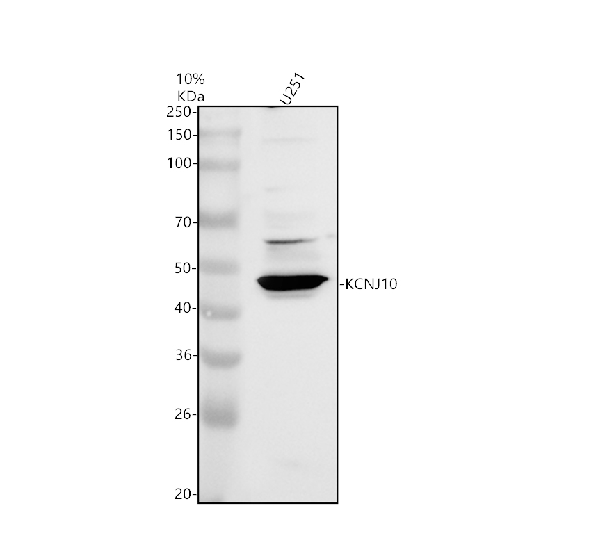 a02619 1 kcnj10 primary antibodies wb testing 1