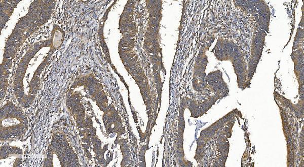 a02621 1 ythdf2 primary antibodies ihc testing 2