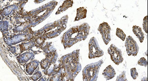 a02621 1 ythdf2 primary antibodies ihc testing 3
