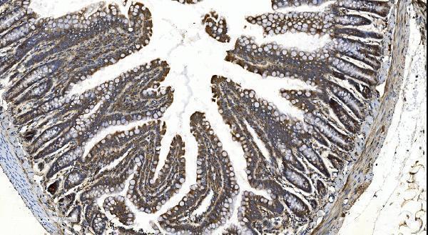 a02621 1 ythdf2 primary antibodies ihc testing 4
