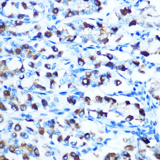 Immunohistochemistry of paraffin-embedded rat stomach using DMT1/SLC11A2 Rabbit pAb  at dilution of 1:100 
