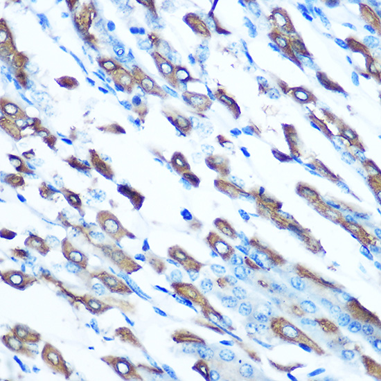 Immunohistochemistry of paraffin-embedded mouse stomach using DMT1/SLC11A2 Rabbit pAb  at dilution of 1:100 