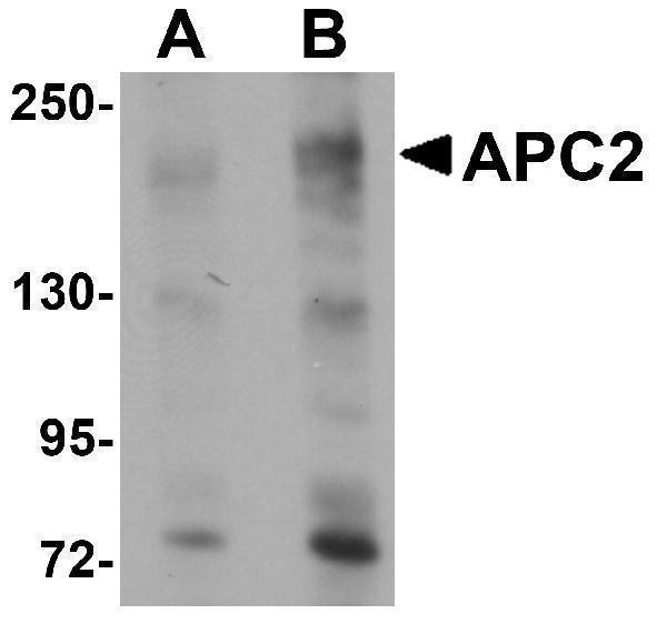 a02624 apc2 primary antibodies wb testing 1