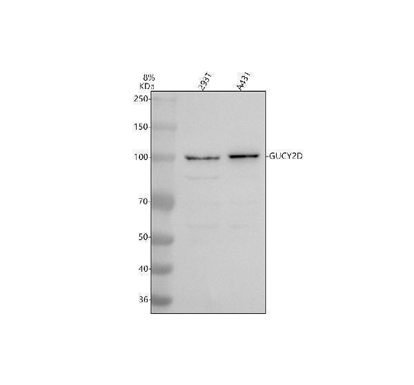 Western blot analysis of GUCY2D using anti-GUCY2D antibody (A02625-1)