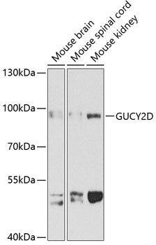 a02625 gucy2d primary antiboties wb testing 1