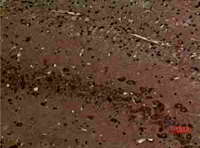 a02627 1 myo6 primary antibodyes ihc testing 2