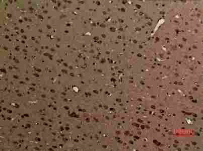 a02627 1 myo6 primary antibodyes ihc testing 3