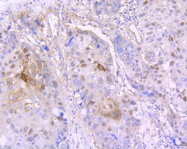 a02628 1 ivl primary antiboties ihc testing 2