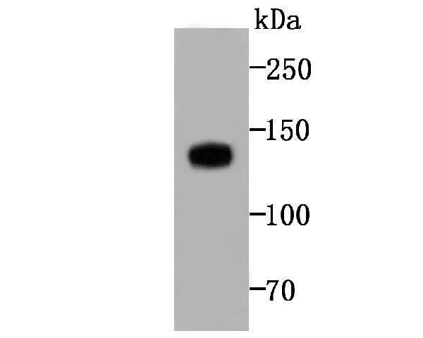 a02628 1 ivl primary antiboties wb testing 1
