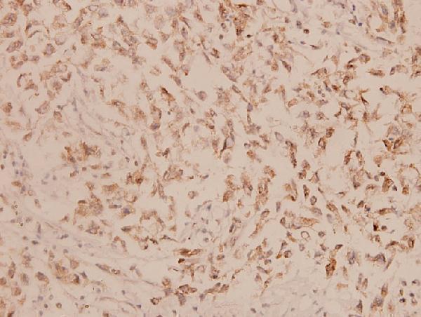 a02628 ivl primary antiboties ihc testing 2