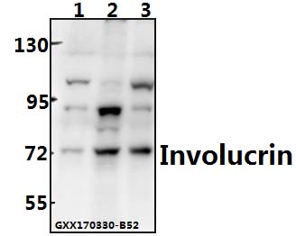 a02628 ivl primary antiboties wb testing 1