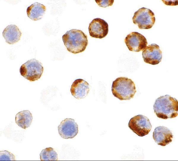 Immunocytochemistry of caspase-6 in MCF7 with caspase-6 antibody at 1 μg/mL