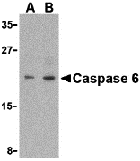Western blot analysis of Caspase-6 in MCF7 cell lysate with Caspase-6 antibody (IN) at (A) 1 and (B) 2 μg/mL