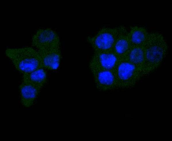 ICC staining Caspase-6 in SW480 cells (green)