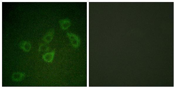 a02631s257 1 casp6 primary antibodies if testing 1
