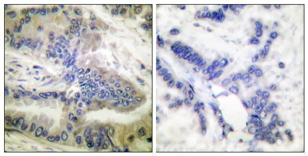 a02631s257 1 casp6 primary antibodies ihc testing 5