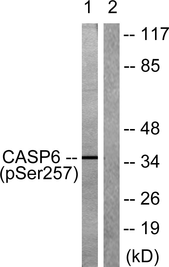 Western blot analysis of lysates from 293 cells treated with Etoposide 25uM 60