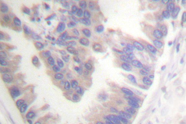 a02631s257 casp6 primary antiboties ihc testing 2