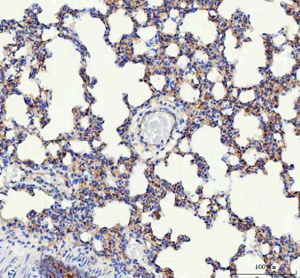 a02632 2 cdh5 primary antibodies ihc testing 2