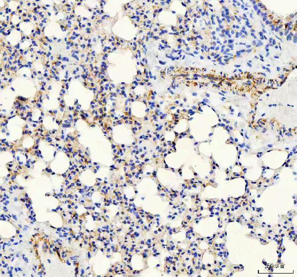 a02632 2 cdh5 primary antibodies ihc testing 3