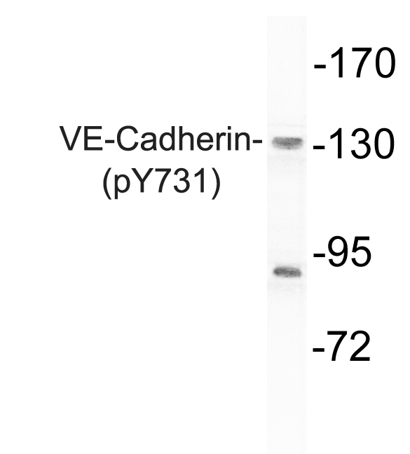 Western blot (WB) analysis of p-VE-Cadherin (Y731) polyclonal antibody at 1:500 dilution
Lane1:Hela cell lysate treated with EGF(0