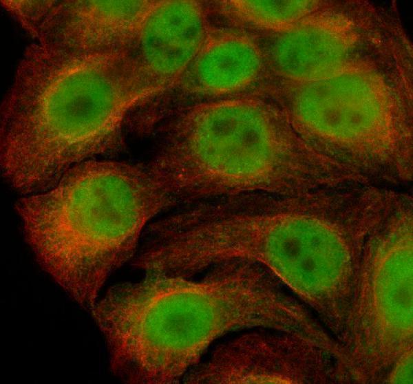 IF analysis of UGT1A4 using anti-UGT1A4 antibody (A02634-1) and anti-Alpha Tubulin antibody (M03989-3)