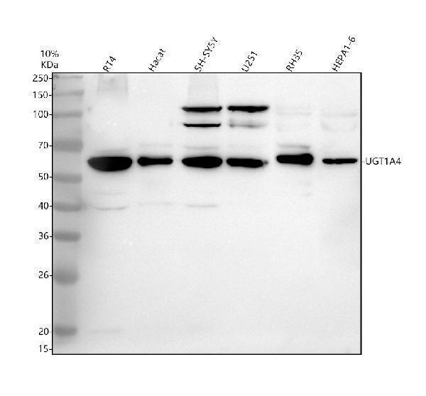 Western blot analysis of UGT1A4 using anti-UGT1A4 antibody (A02634-1)