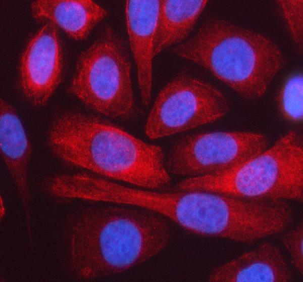 a02635 1 actn1 primary antibodies if testing 1