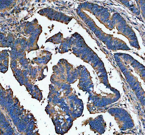 a02635 1 actn1 primary antibodies ihc testing 1