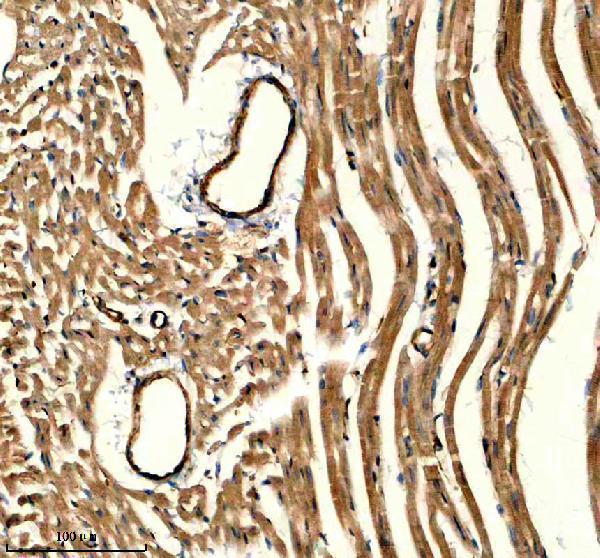 a02635 1 actn1 primary antibodies ihc testing 2