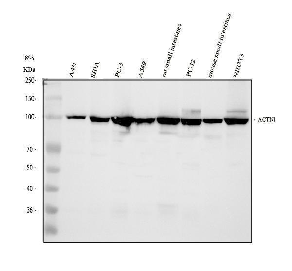 a02635 1 actn1 primary antibodies wb testing 1_1
