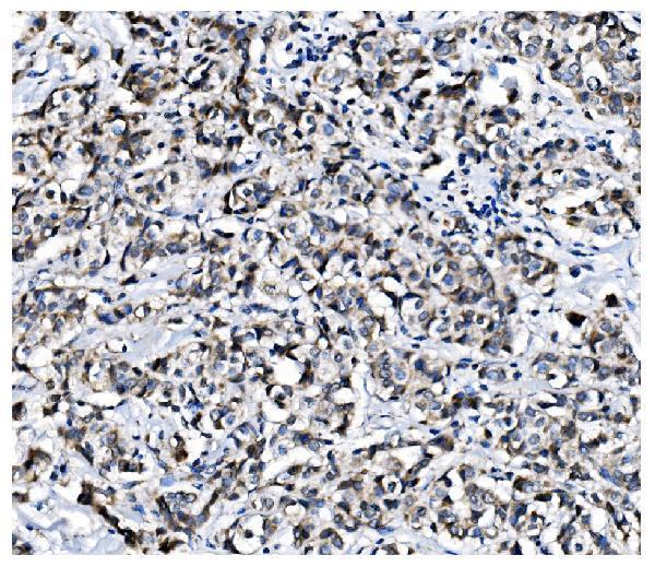 a02636 1 pcbp1 primary antibodies ihc testing 5