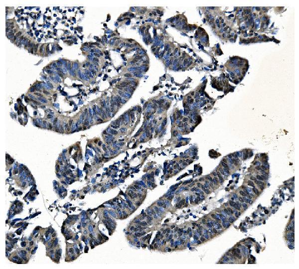 a02636 1 pcbp1 primary antibodies ihc testing 7