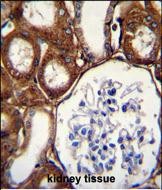 a02637 anti gpx3 antibody center ihc p testing 4