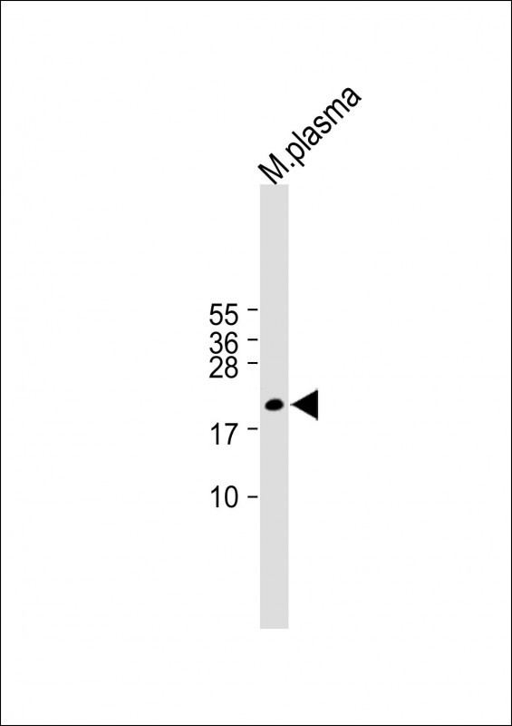 All lanes : Anti-GPX3 Antibody (Center) at 1:1000 dilutionLane 1: M