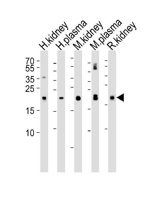 Western blot analysis of lysates from human kidney, plasma, mouse kidney, plasma and rat kidney tissue lysate (from left to right), using GPX3 Antibody (Center) (Cat