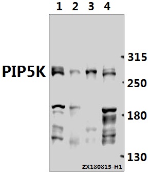 a02638 pikfyve primary antiboties wb testing 1