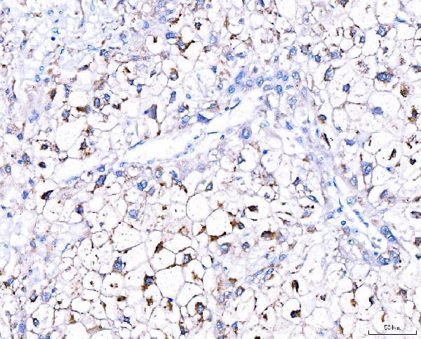  IHC analysis of GGCX using anti-GGCX antibody (A02643-1)