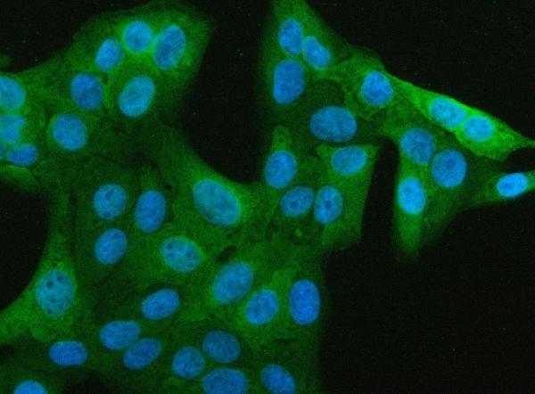 a02644 2 jchain primary antibodies if testing 5