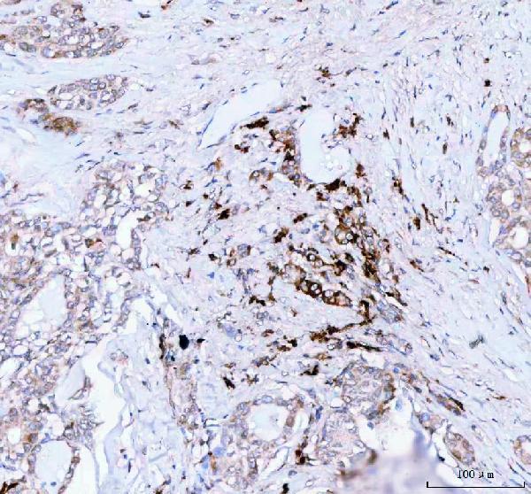  IHC analysis of JCHAIN using anti-JCHAIN antibody (A02644-2)