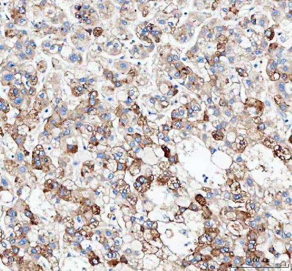  IHC analysis of JCHAIN using anti-JCHAIN antibody (A02644-2)