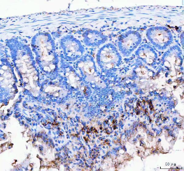 a02644 2 jchain primary antibodies ihc testing 4
